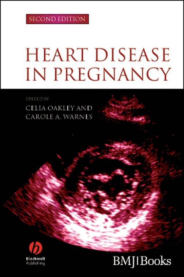 Heart Disease in Pregnancy 2e