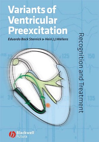 Variants of Ventricular Preexcitation – Recognition and Treatment