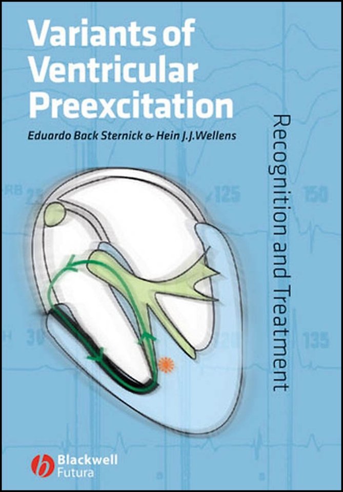 Variants of Ventricular Preexcitation – Recognition and Treatment