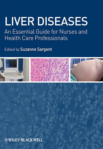 Liver Diseases – An Essential Guide for Nurses and Health Care Professionals