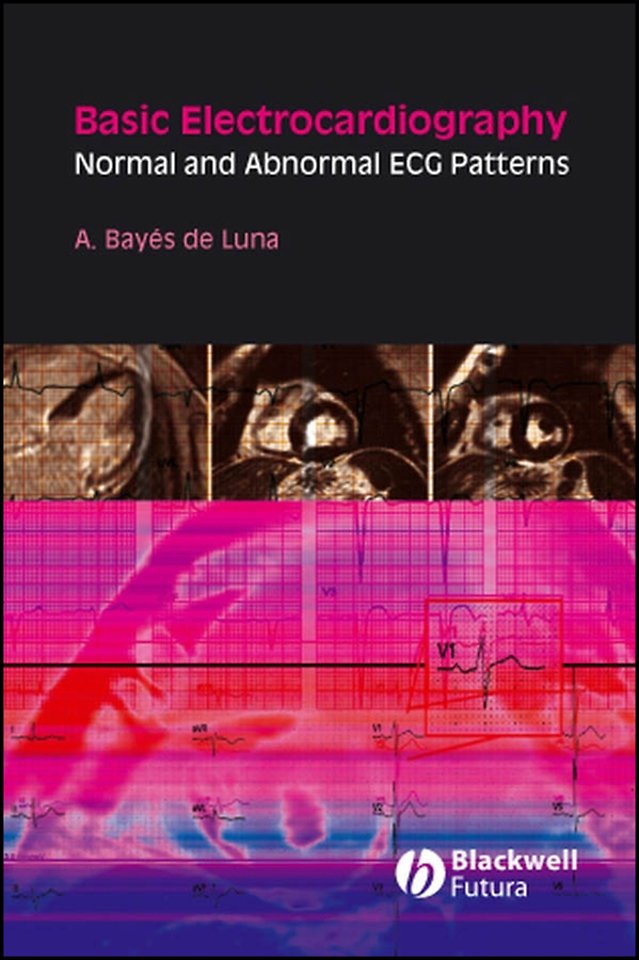 Basic Electrocardiography – Normal and Abnormal ECG Patterns