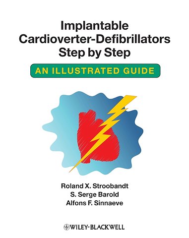 Implantable Cardioverter – Defibrillators Step by Step – An Illustrated Guide