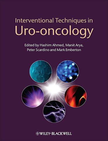 Interventional Techniques in Uro–oncology