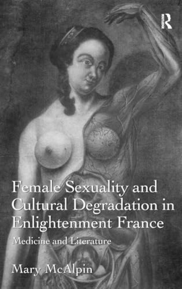 Female Sexuality and Cultural Degradation in Enlightenment France
