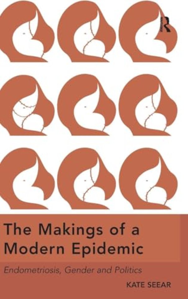 Makings of a Modern Epidemic