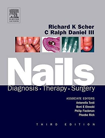 Nails