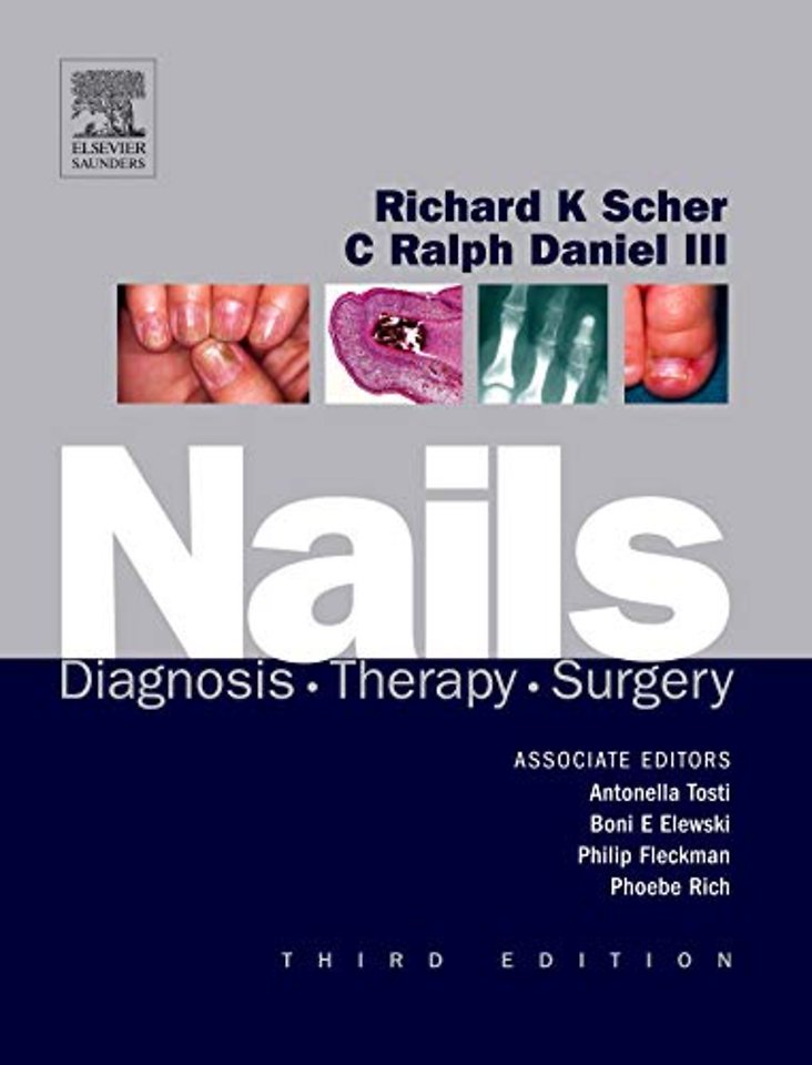 Nails