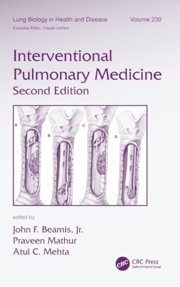Interventional Pulmonary Medicine