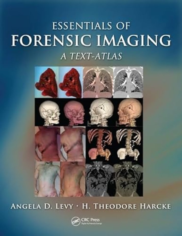 Essentials of Forensic Imaging