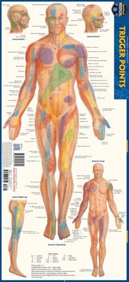 Trigger points