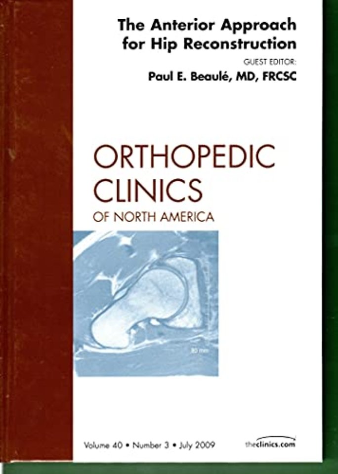 The Anterior Approach for Hip Reconstruction, An Issue of Orthopedic Clinics