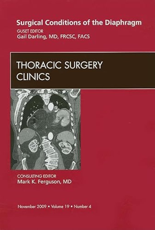 Surgical Conditions of the Diaphragm, An Issue of Thoracic Surgery Clinics