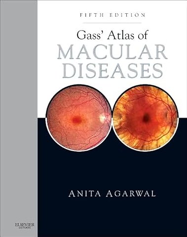 Gass' Atlas of Macular Diseases