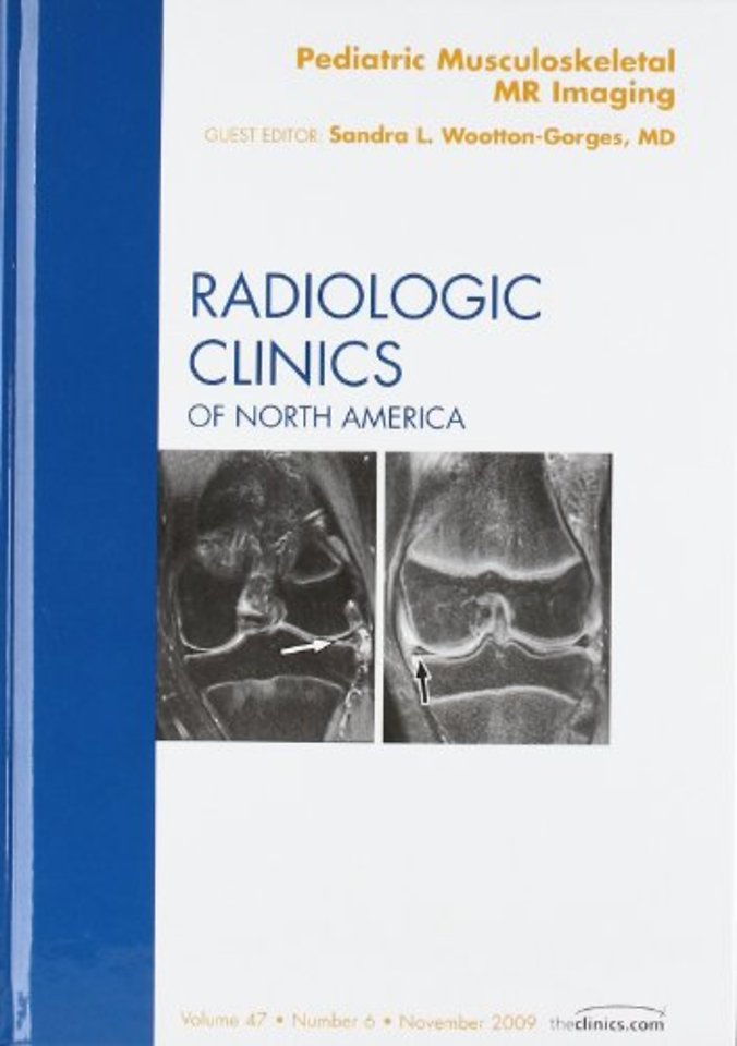 Pediatric Musculoskeletal MR Imaging, An Issue of Radiologic Clinics of North America
