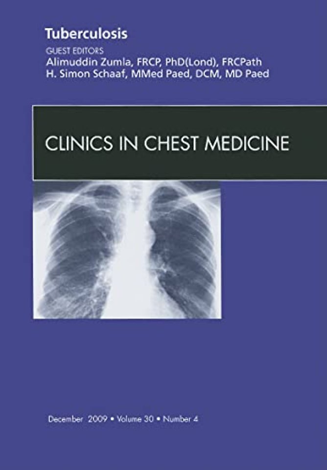 Tuberculosis, An Issue of Clinics in Chest Medicine