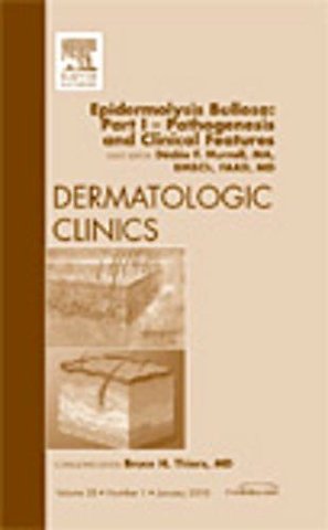 Epidermolysis Bullosa: Part I - Pathogenesis and Clinical Features, An Issue of Dermatologic Clinics