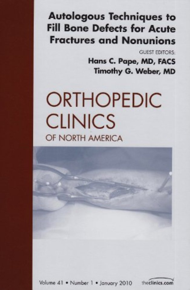 Autologous Techniques to Fill Bone Defects for Acute Fractures and Nonunions, An Issue of Orthopedic Clinics