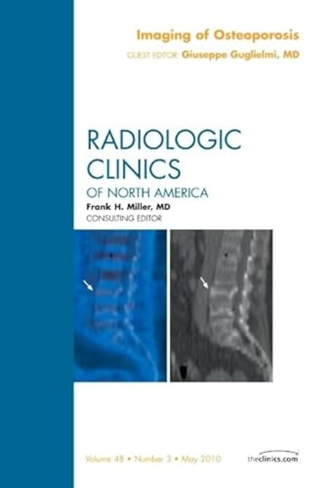 Imaging of Osteoporosis, An Issue of Radiologic Clinics of North America