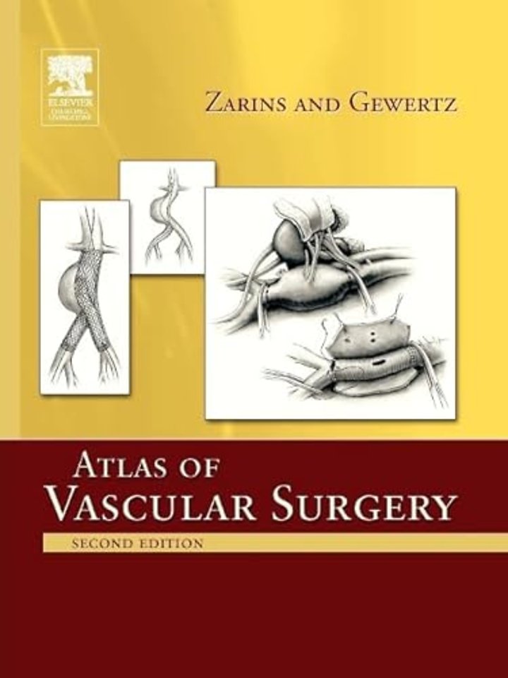 Atlas Of Vascular Surgery - Paperback Edition