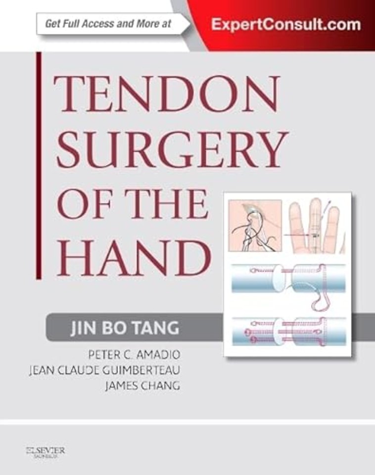 Tendon Surgery of the Hand