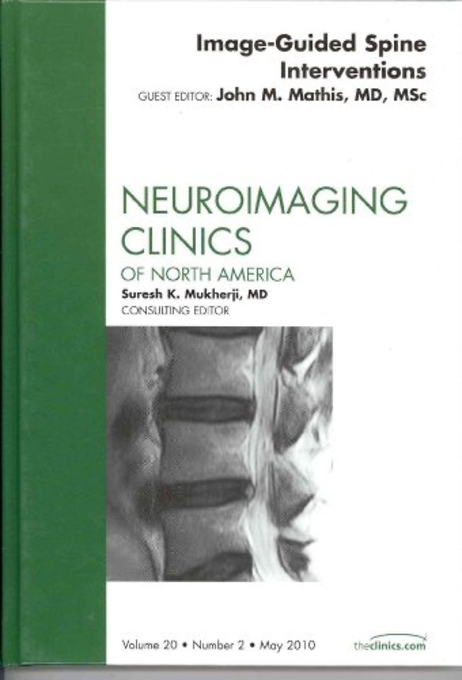 Image-Guided Spine Interventions, An Issue of Neuroimaging Clinics