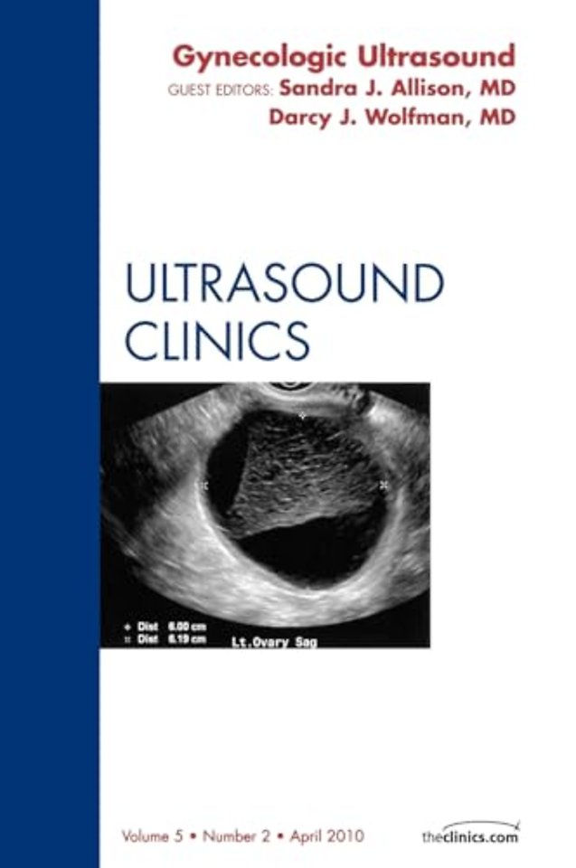 Gynecologic Ultrasound, An Issue of Ultrasound Clinics