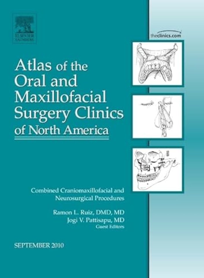 Combined Craniomaxillofacial and Neurosurgical Procedures, An Issue of Atlas of the Oral and Maxillofacial Surgery Clinics
