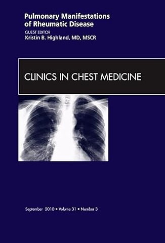 Pulmonary Manifestations of Rheumatic Disease, An Issue of Clinics in Chest Medicine