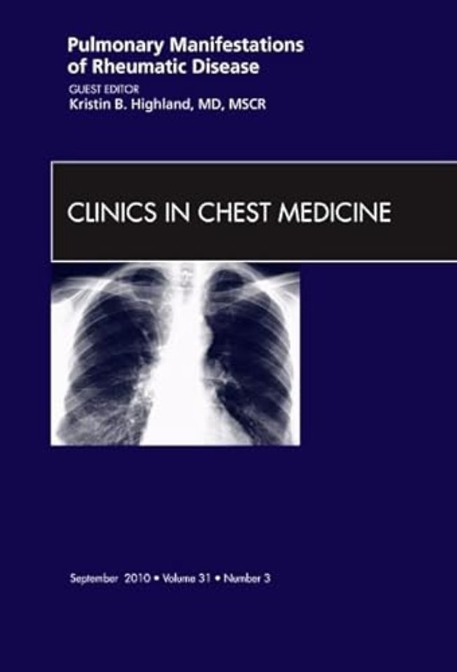 Pulmonary Manifestations of Rheumatic Disease, An Issue of Clinics in Chest Medicine
