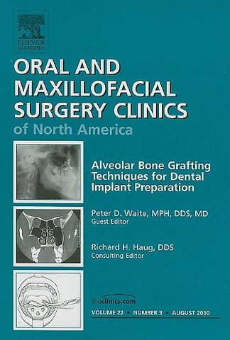 Alveolar Bone Grafting Techniques for Dental Implant Preparation, An Issue of Oral and Maxillofacial Surgery Clinics