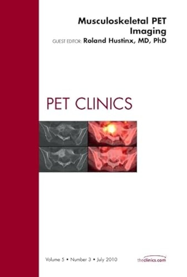 Musculoskeletal PET Imaging, An Issue of PET Clinics