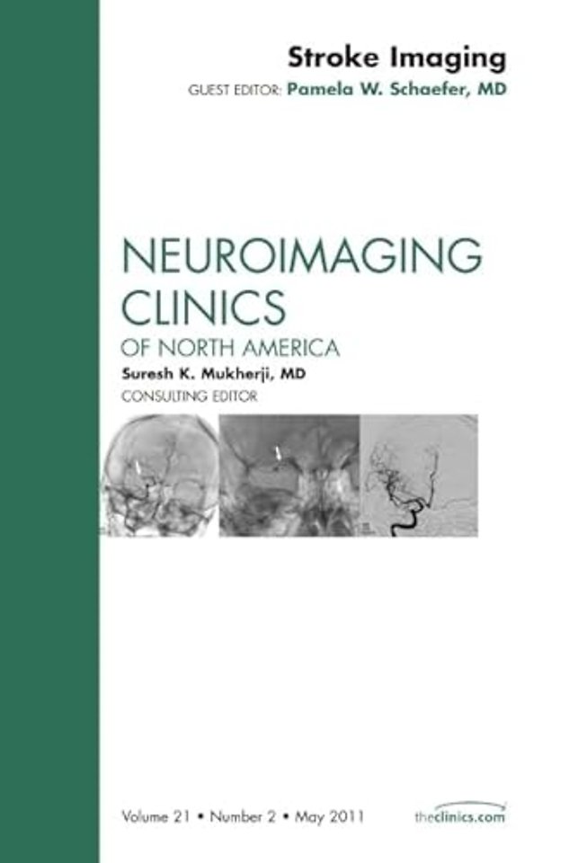 Stroke Imaging, An Issue of Neuroimaging Clinics