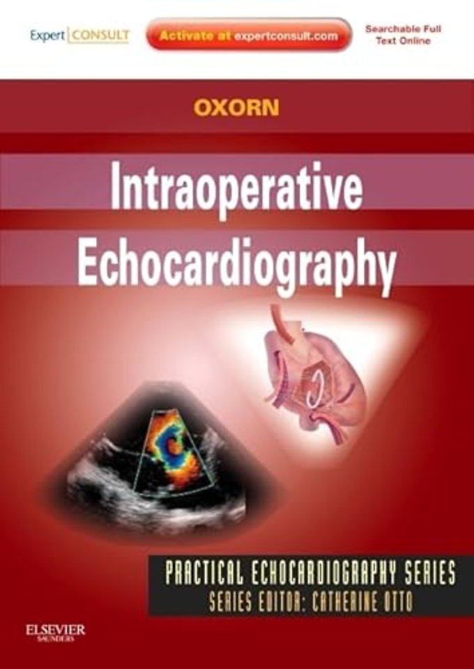 Intraoperative Echocardiography