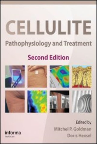 Cellulite