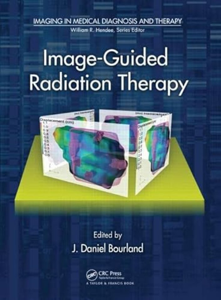 Image-Guided Radiation Therapy