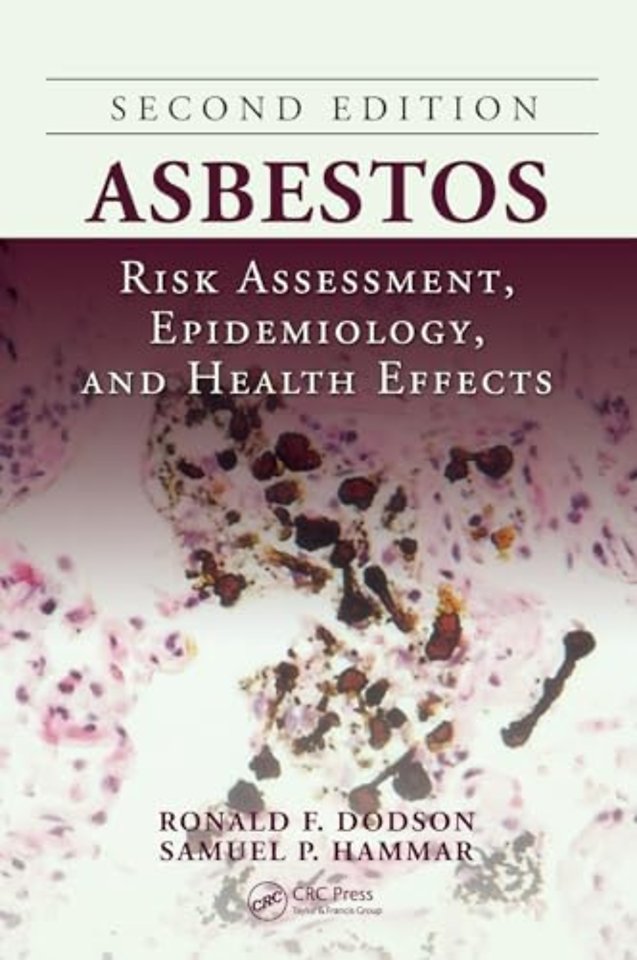 Asbestos