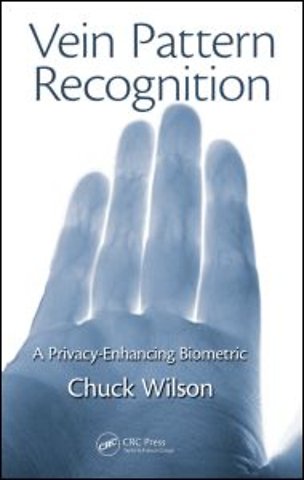 Vein Pattern Recognition