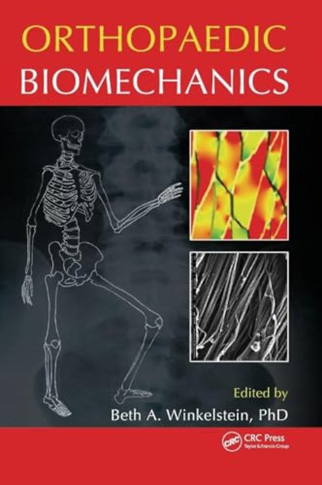 Orthopaedic Biomechanics