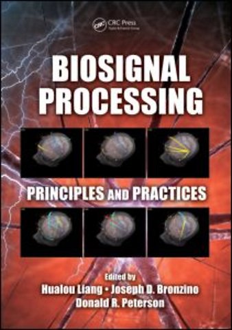 Biosignal Processing
