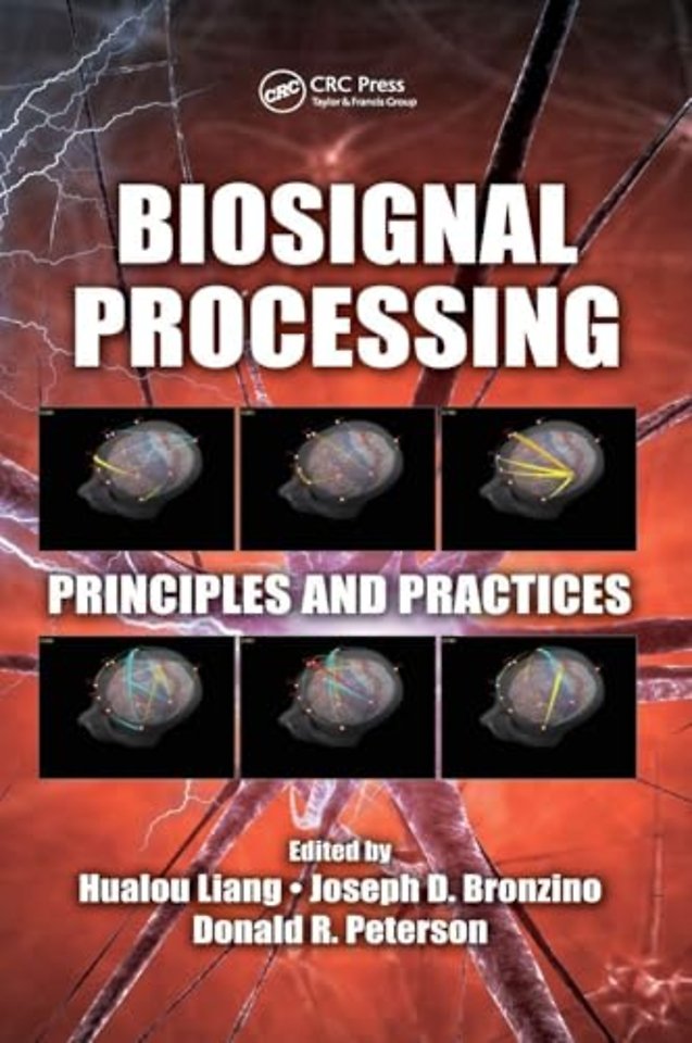 Biosignal Processing