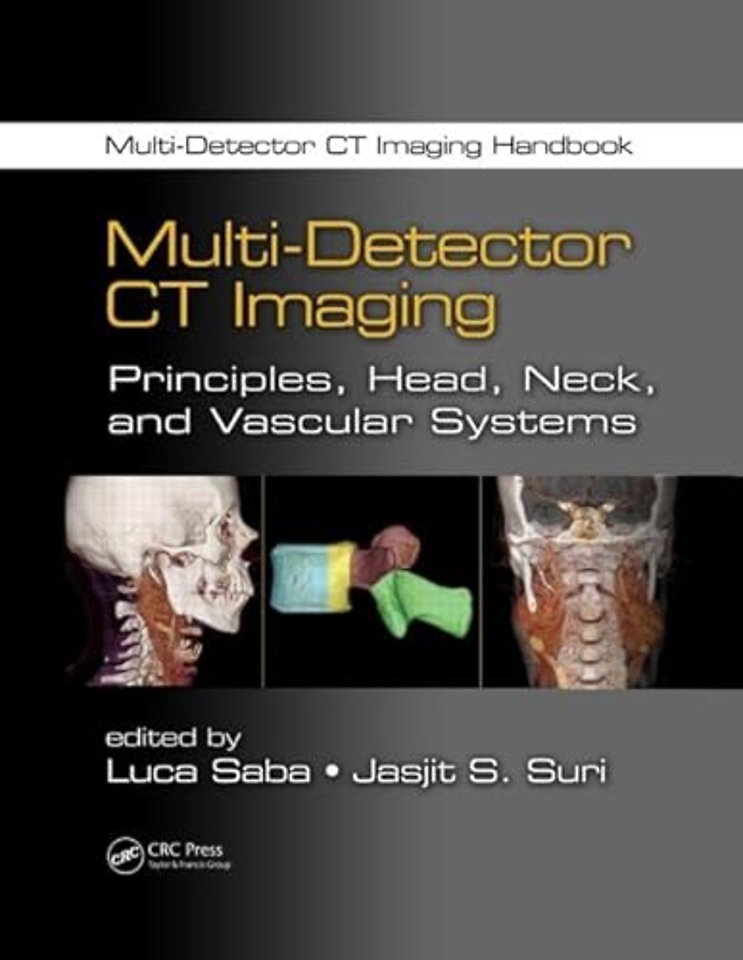Multi-Detector CT Imaging