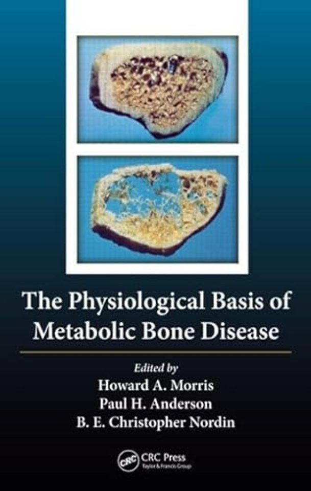 Physiological Basis of Metabolic Bone Disease