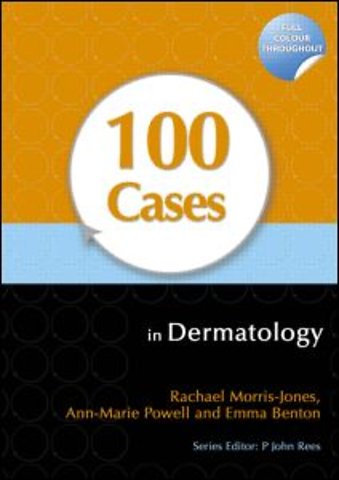 100 Cases in Dermatology