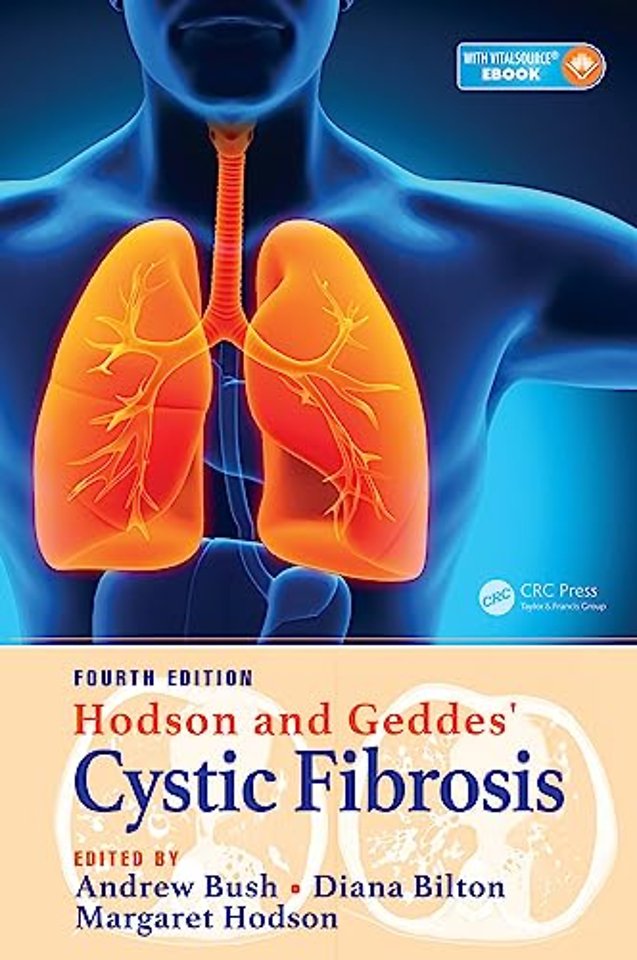 Hodson and Geddes' Cystic Fibrosis