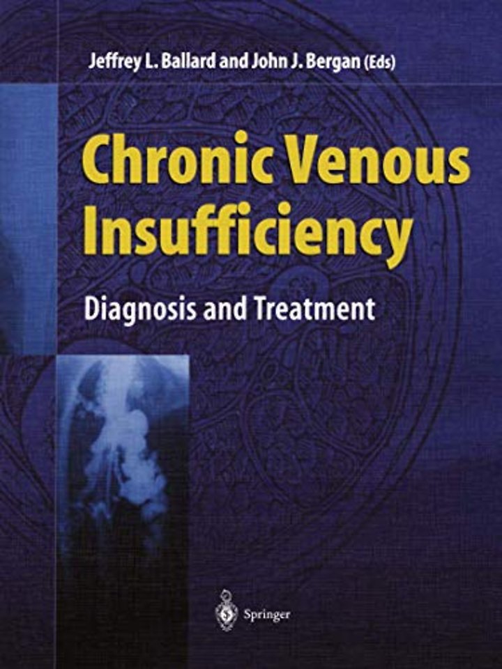 Chronic Venous Insufficiency