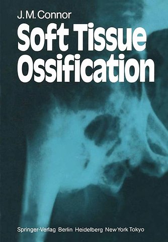 Soft Tissue Ossification
