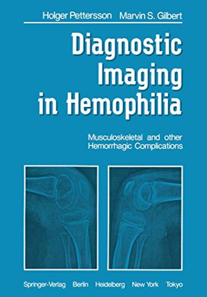 Diagnostic Imaging in Hemophilia