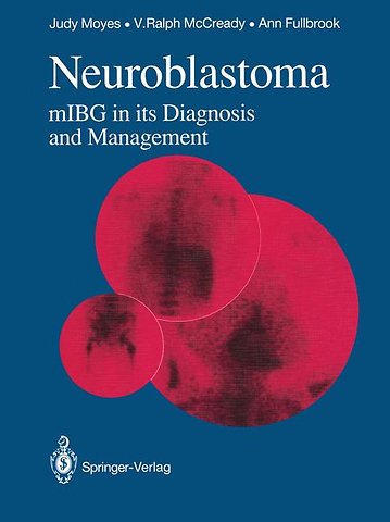 Neuroblastoma