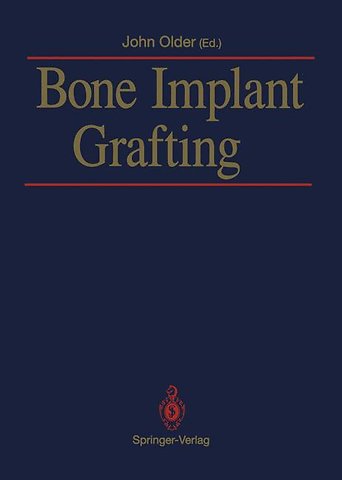 Bone Implant Grafting