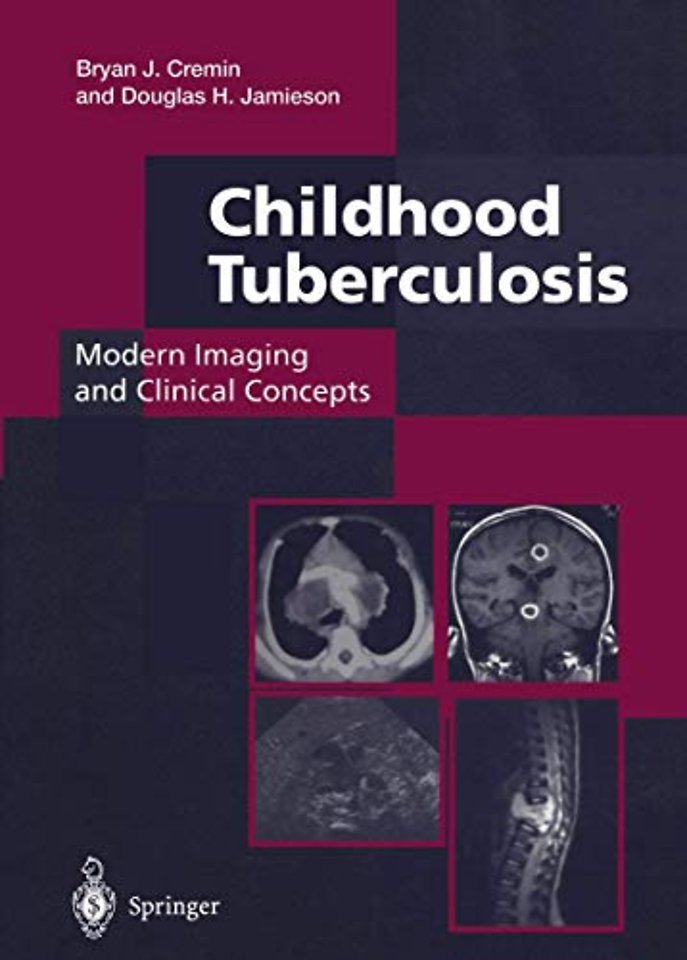 Childhood Tuberculosis: Modern Imaging and Clinical Concepts